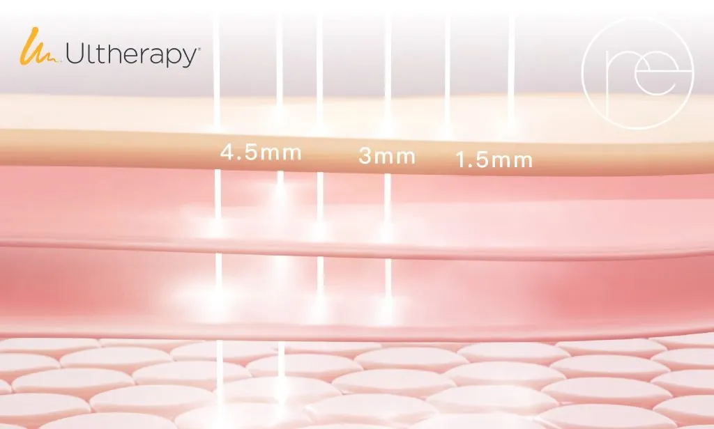 Ultherapy 採用非入侵高能量聚焦超聲波技術